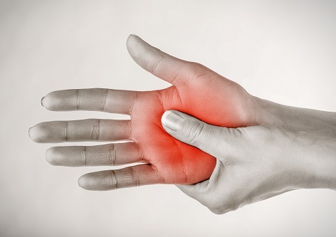 Commonly Asked Questions About Arthritis